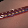 varicose veins treatment singapore